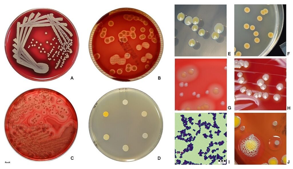 La ricetta che calma l’ansia e prepara la resistenza: il vero costo degli antibiotici inutili